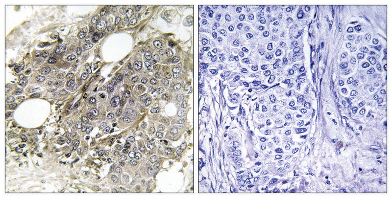 Merck Anti-TGF beta Receptor III, C-Terminal antibody produced in rabbit