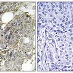 Merck Anti-TGF beta Receptor III, C-Terminal antibody produced in rabbit