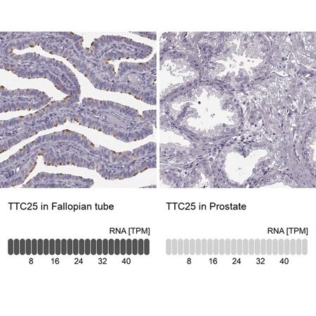 Merck ANTI-TTC25