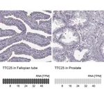 Merck ANTI-TTC25
