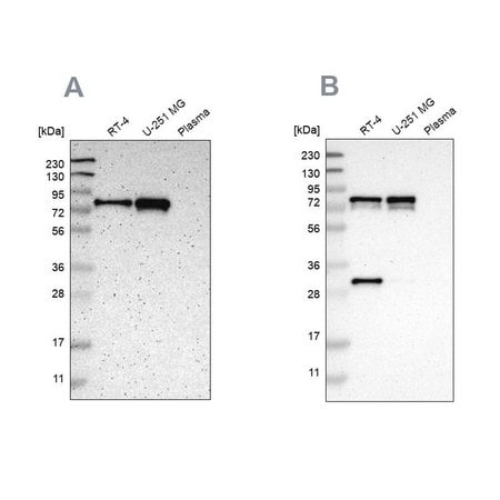 Merck Anti-MTDH antibody produced in rabbit