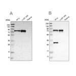 Merck Anti-MTDH antibody produced in rabbit