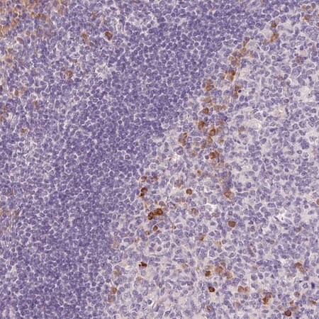 Merck Anti-FAM46C antibody produced in rabbit