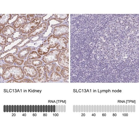 Merck Anti-SLC13A1 antibody produced in rabbit