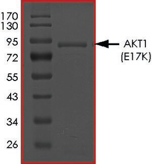 Merck AKT1 (E17K), ACTIVE