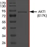 Merck AKT1 (E17K), ACTIVE