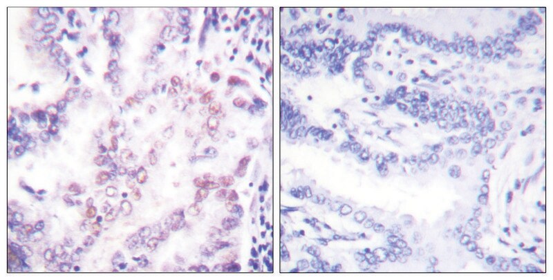 Merck Anti-Thyroid Hormone Receptor beta, N-Terminal antibody produced in rabbit