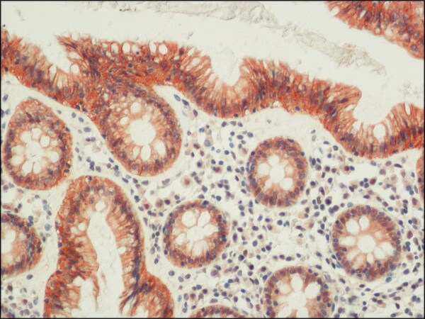 Merck Anti-Occludin antibody from rabbit