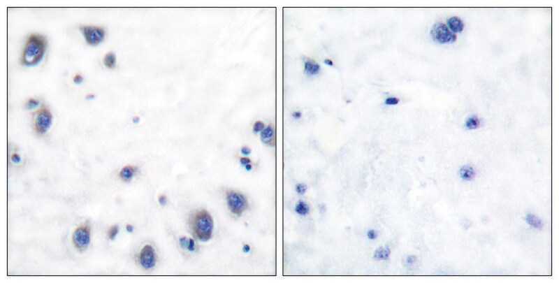 Merck Anti-Tyrosine Hydroxylase, N-Terminal antibody produced in rabbit