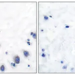 Merck Anti-Tyrosine Hydroxylase, N-Terminal antibody produced in rabbit