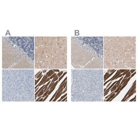 Merck Anti-CACNA2D1 antibody produced in rabbit