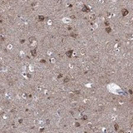Merck Anti-SHOC2 antibody produced in rabbit