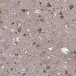 Merck Anti-SHOC2 antibody produced in rabbit