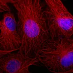 Thermo Fisher Scientific Rabbit anti-Mouse IgG (H+L) Superclonal Secondary Antibody, Alexa Fluor 555