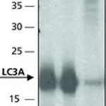 Merck ANTI-LC3A
