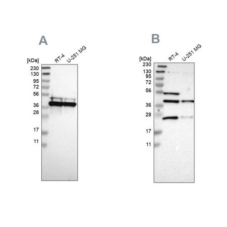 Merck Anti-CCDC51 antibody produced in rabbit
