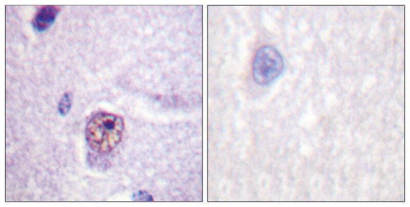 Merck Anti-SF1, N-Terminal antibody produced in rabbit