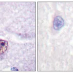 Merck Anti-SF1, N-Terminal antibody produced in rabbit