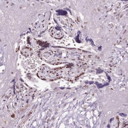 Merck Anti-SRSF4 antibody produced in rabbit