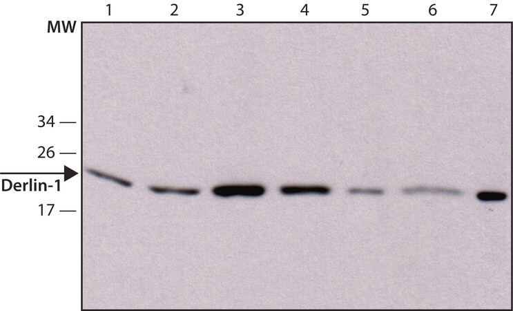 Merck Anti-Derlin-1 antibody, Mouse monoclonal
