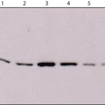 Merck Anti-Derlin-1 antibody, Mouse monoclonal