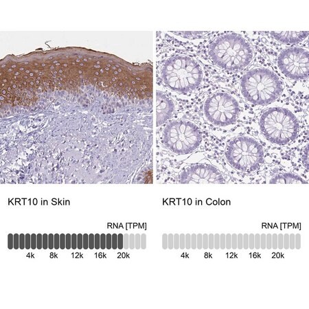 Merck Anti-KRT10 antibody produced in rabbit