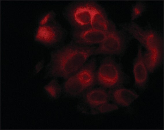 Merck Anti-STIM1 (C-terminal) antibody produced in rabbit