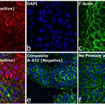 Thermo Fisher Scientific Goat anti-Rabbit IgG (H+L) Cross-Adsorbed Secondary Antibody, Cyanine5