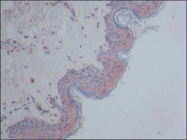 Merck Anti-CYLD antibody produced in rabbit
