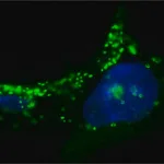 Merck Anti-ADFP / PLIN2 antibody, Mouse monoclonal