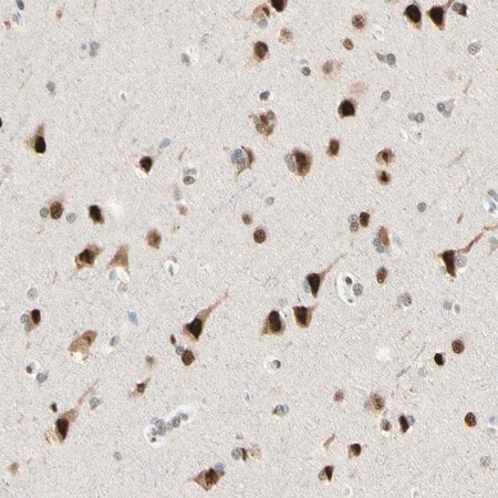 Merck Anti-ATXN1 antibody produced in rabbit