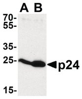 Merck ANTI-HIV-1 P24