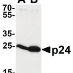 Merck ANTI-HIV-1 P24