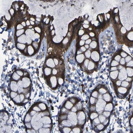 Merck Anti-SGK2 antibody produced in rabbit