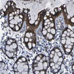 Merck Anti-SGK2 antibody produced in rabbit