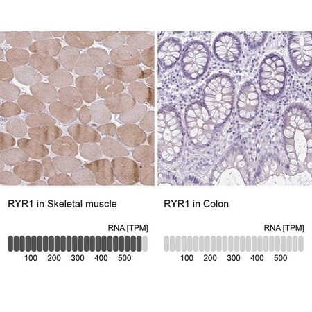 Merck Anti-RYR1 antibody produced in rabbit