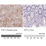 Merck Anti-RYR1 antibody produced in rabbit