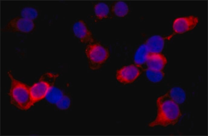 Merck Monoclonal Anti-WDR62 antibody produced in mouse