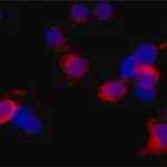 Merck Monoclonal Anti-WDR62 antibody produced in mouse