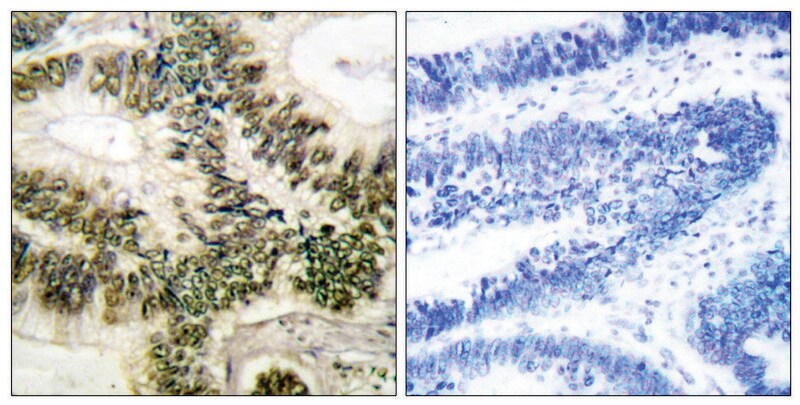 Merck Anti-Cyclin E1 antibody produced in rabbit