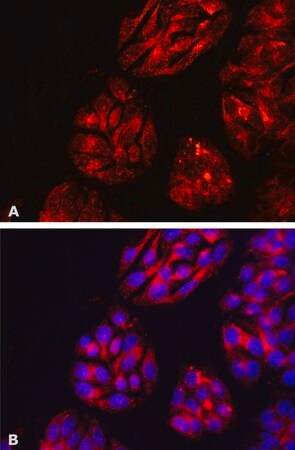 Merck Anti-DPP4/CD26 antibody, Mouse monoclonal