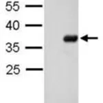 Merck MONOCLONAL ANTI-S TAG