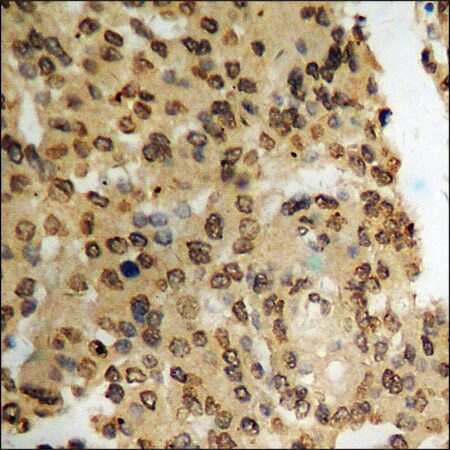 Merck Anti-phospho-PDK1 (pSer241) antibody produced in rabbit
