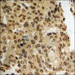 Merck Anti-phospho-PDK1 (pSer241) antibody produced in rabbit