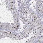 Merck Anti-H1-1 antibody produced in rabbit