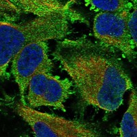 Atlas Antibodies Anti-SNAP25 Antibody