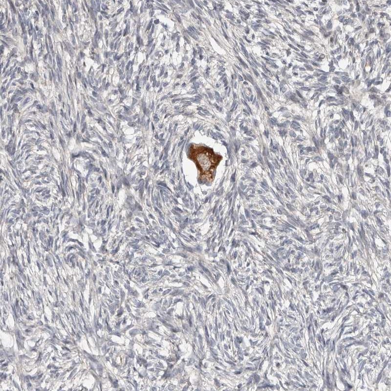 Atlas Antibodies Anti-SMYD4 Antibody