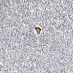 Atlas Antibodies Anti-SMYD4 Antibody