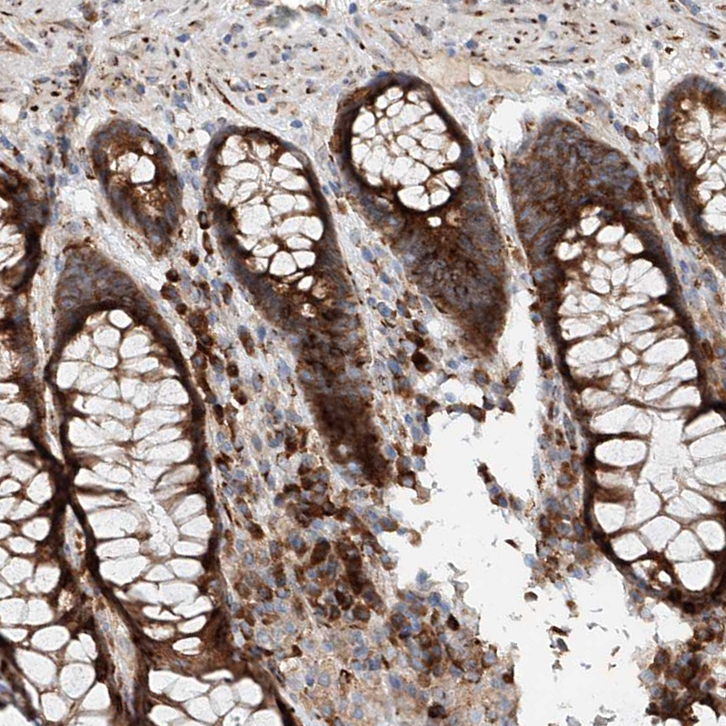 Atlas Antibodies Anti-SNAP29 Antibody