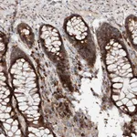 Atlas Antibodies Anti-SNAP29 Antibody
